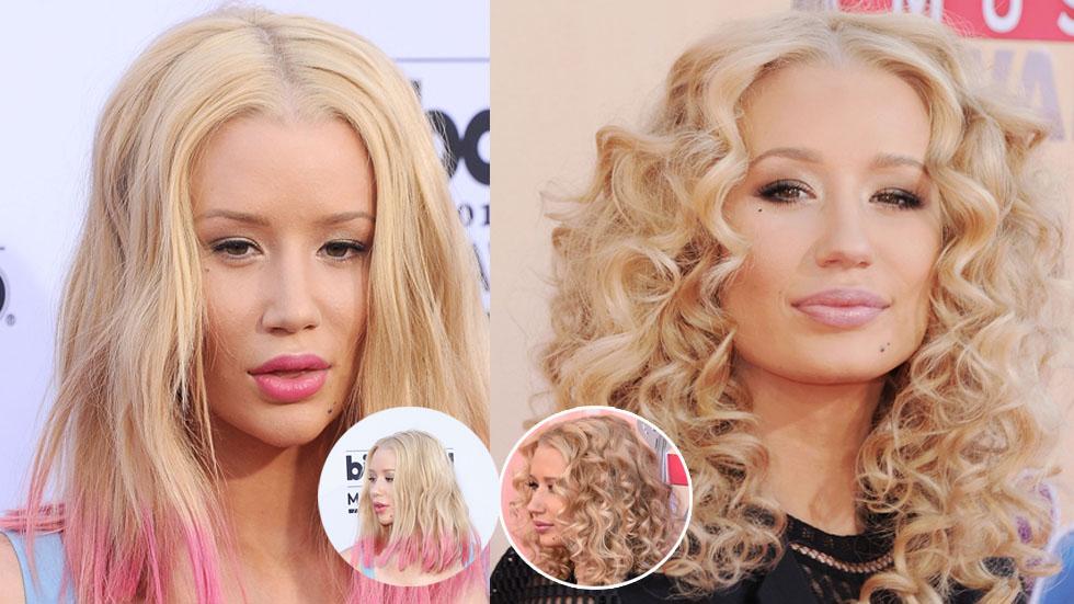 Is That A New Face? Iggy Azalea Sparks More Plastic Surgery Rumors At ...