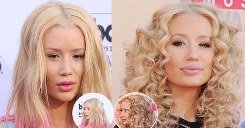 Iggy azalea plastic surgery face 01
