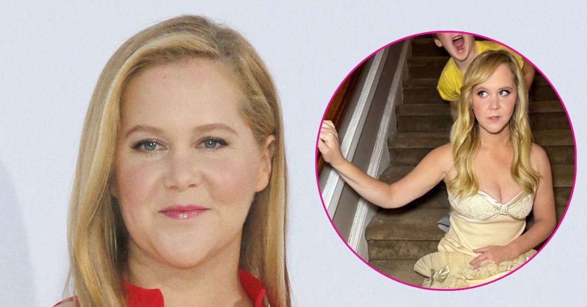 amy schumer yellow dress transformation