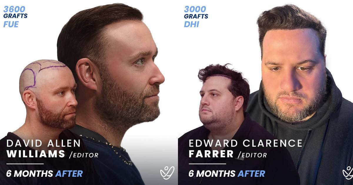 baldstool eddie dave after pics reuinion estenove