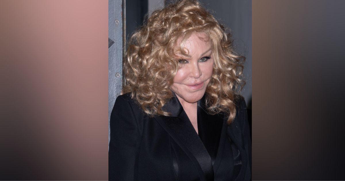 jocelyn wildenstein plastic surgery face transformation