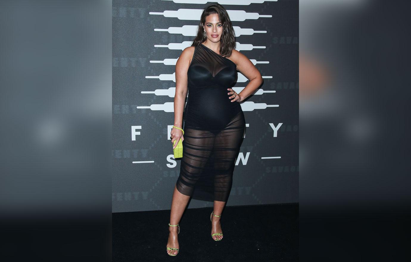 Ashley Graham Shows Off Bruises From Gua Sha Treatment