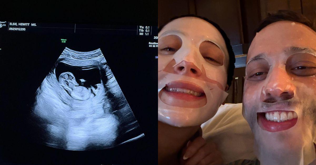 pete davidson girlfriend elsie hewitt confirms pregnant first child