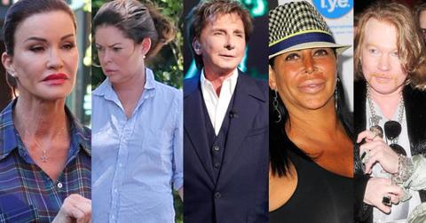 celebrity plastic surgery transformation