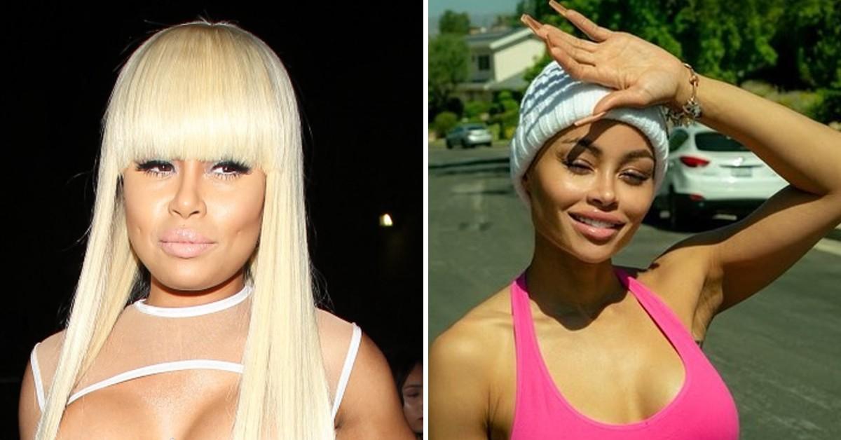 Black Chyna's Iconic Transformation After Reversing Plastic Surgery