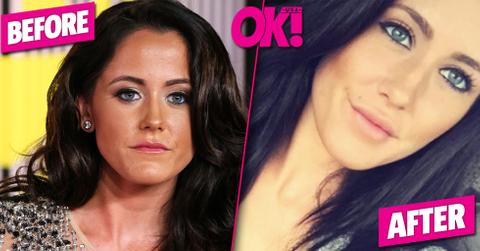 Jenelle evans lip fillers 06
