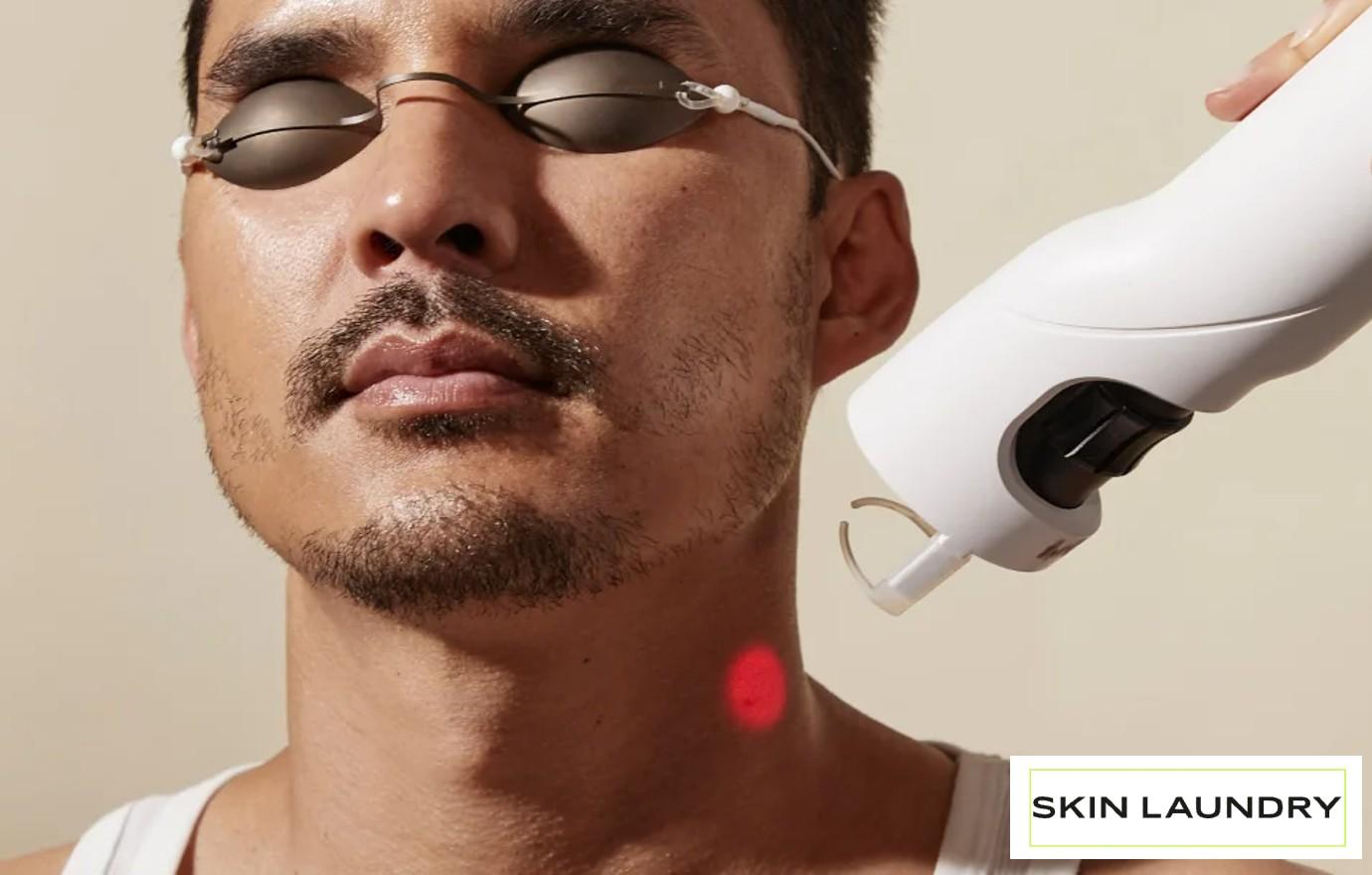 Skin Laundry Laser Treatments