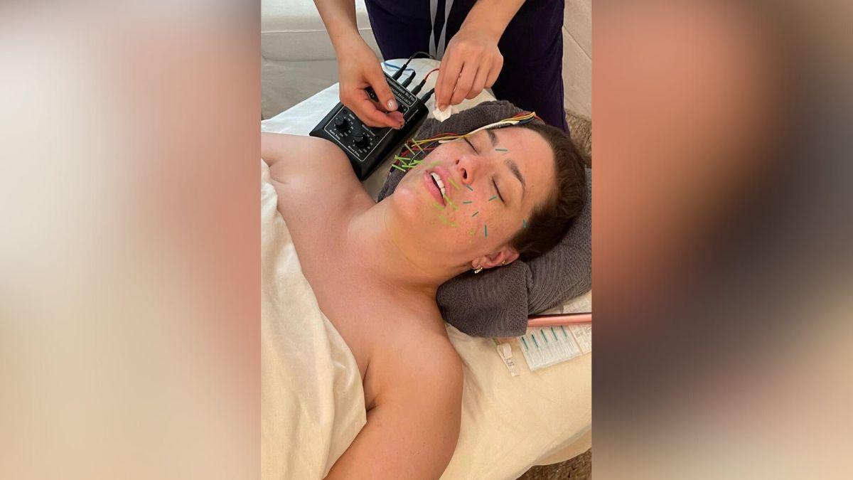 Image of Ashley Graham has praised acupuncture treatments.
