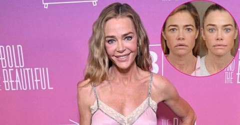 Image of Denise Richards and (inset) before and after facelift.