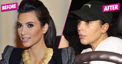 Kim Kardashian Plastic Surgery Nose Job