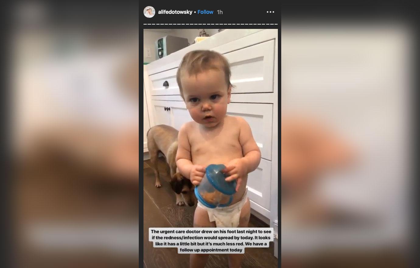 Ali-Fedotowsky-Son-Splinter-Infection