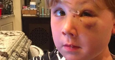Kim zolciak son attacked by dog photos