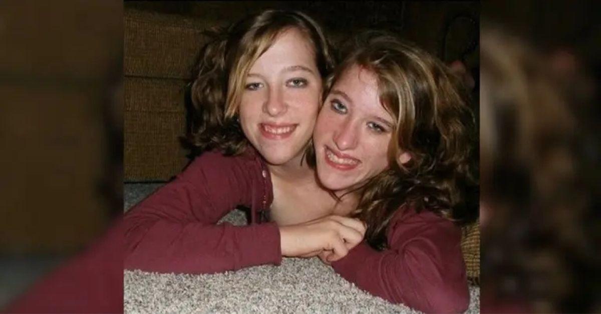 abby brittany hensels baby what to know