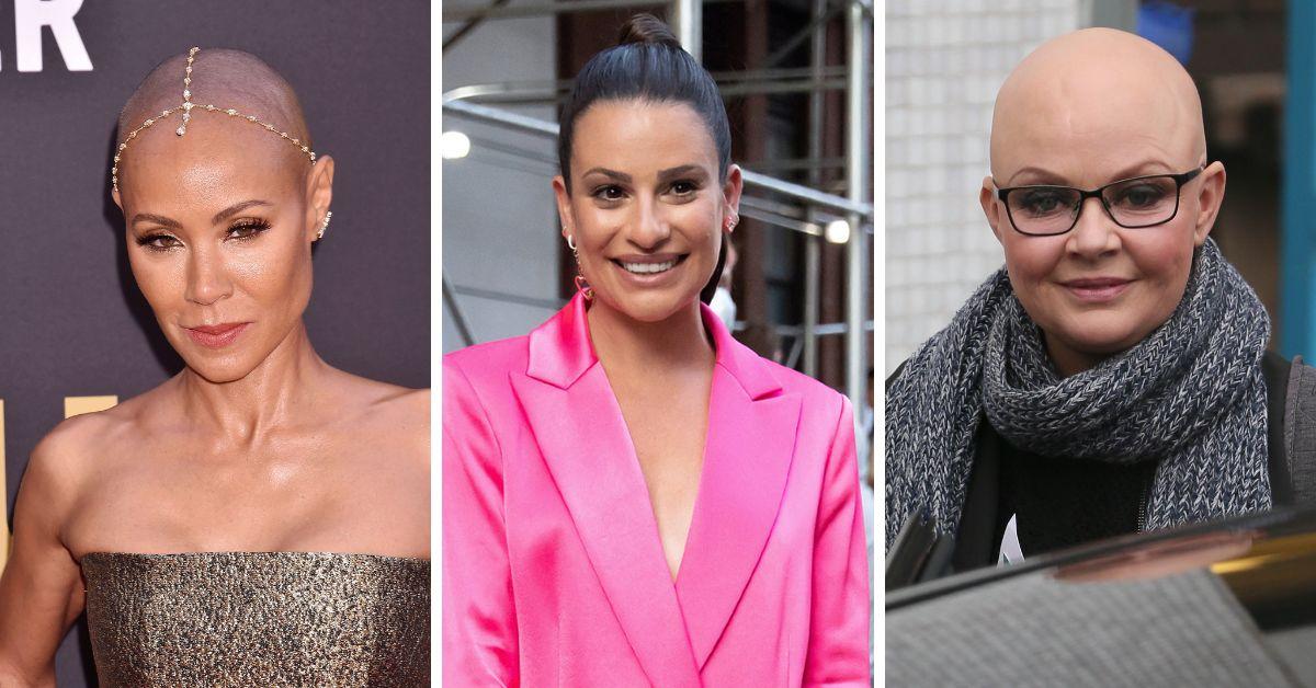 14 Celebrities Who Battle Hair Loss Gail Porter Lea Michele More