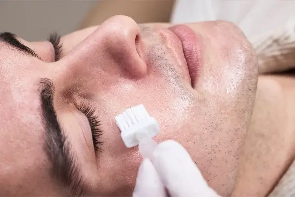 light peel at ject