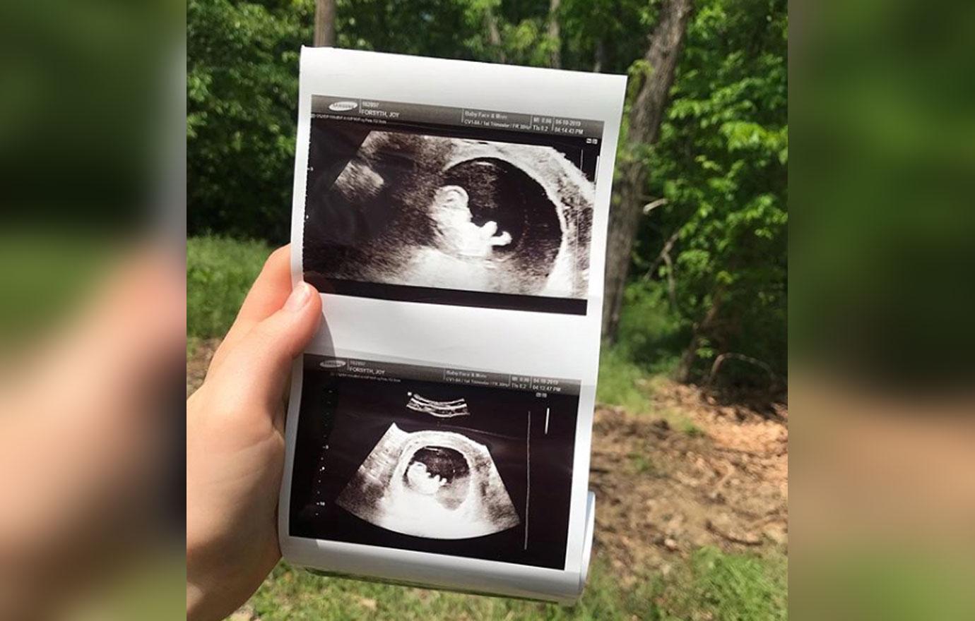 joy anna duggar ultrasound