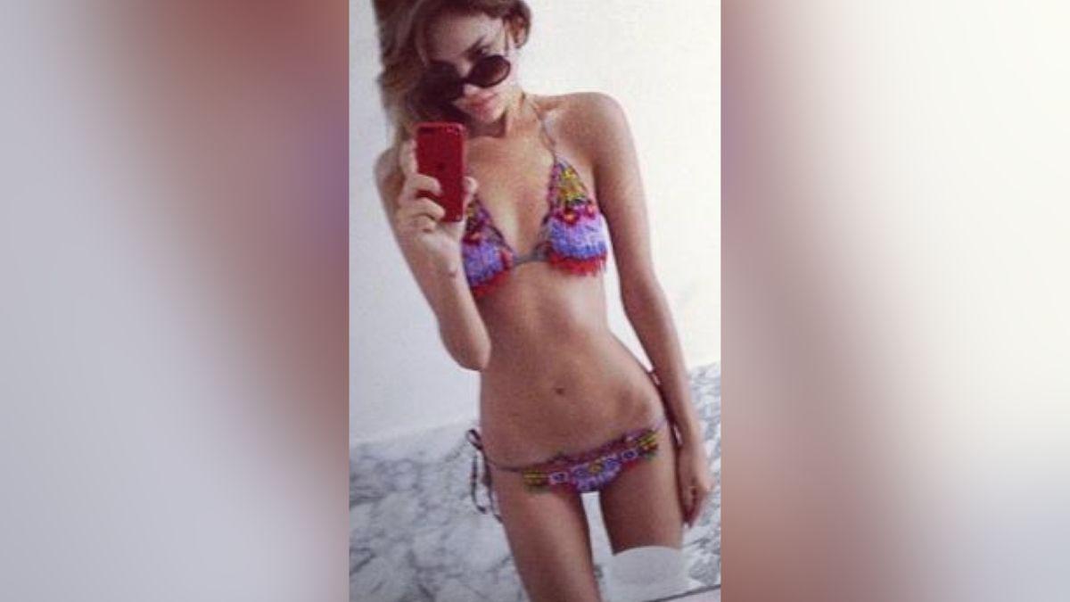 Image of González spoke out for Eating Disorder Awareness Week.