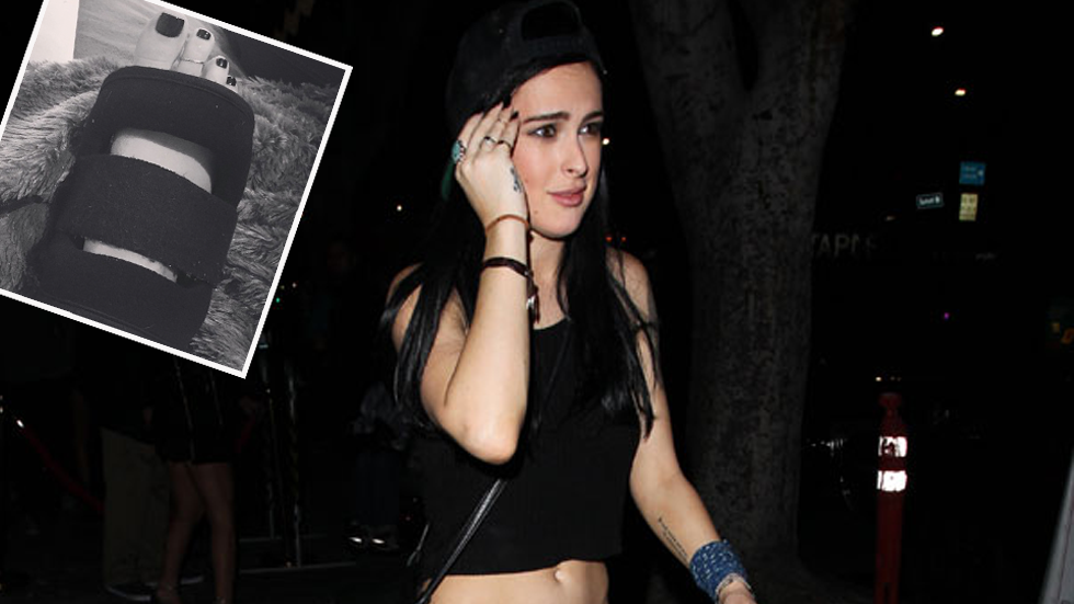 Rumer willis broken foot dwts