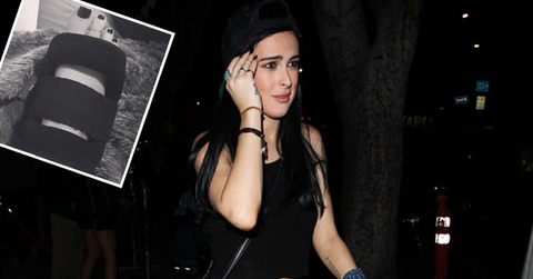 Rumer willis broken foot dwts