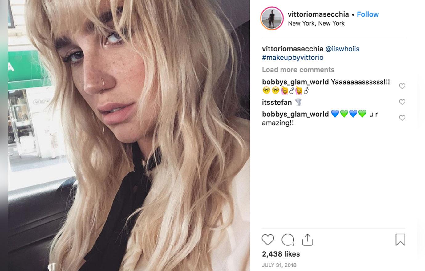 Kesha Shows Off Her Freckles In Gorgeous Makeup-Free Selfie