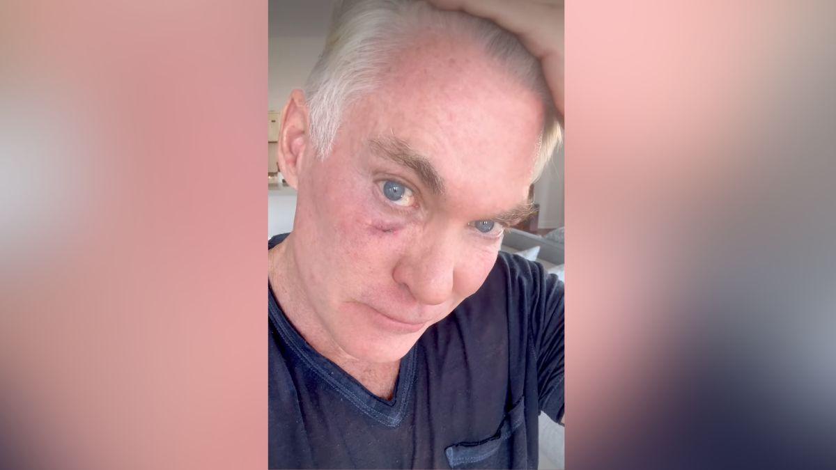 Image of Sam Champion is transparent about his health struggles.