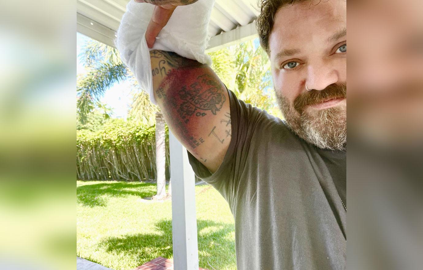 Jackass Alum Bam Margera Reported Missing After Fleeing Rehab Center hq image