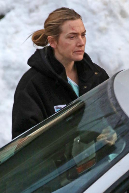 *EXCLUSIVE* A bruised Kate Winslet finishes scenes at the hospital