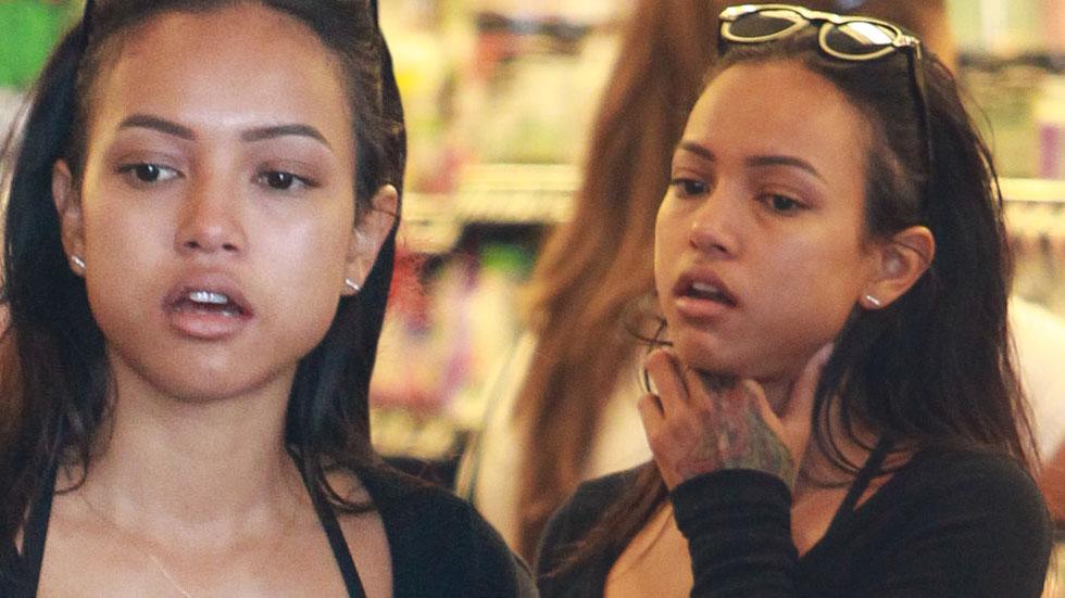 Karrueche trna swollen face boobs legs