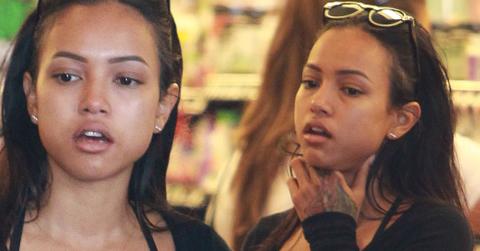 Karrueche trna swollen face boobs legs