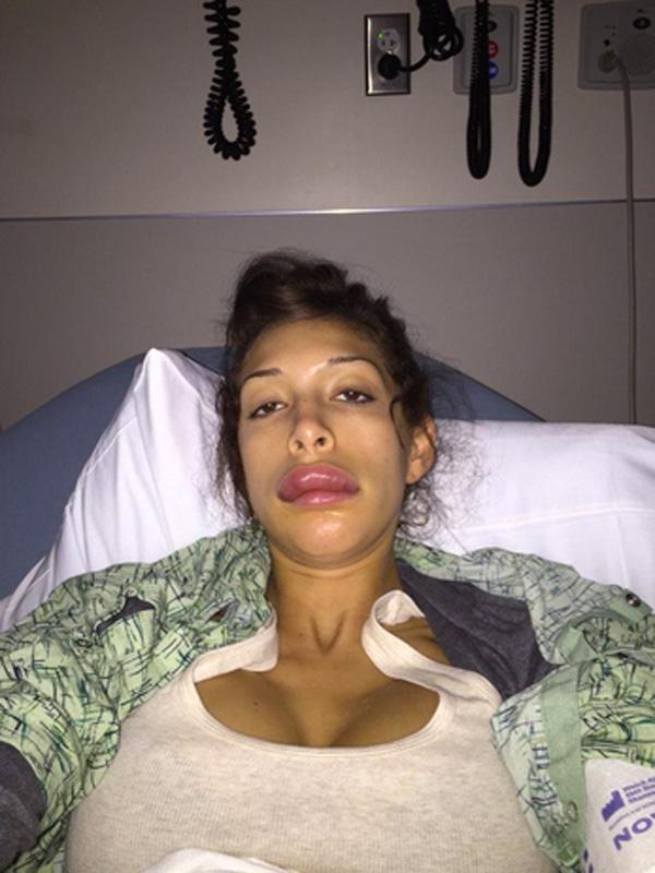 Farrah abraham plastic surgery