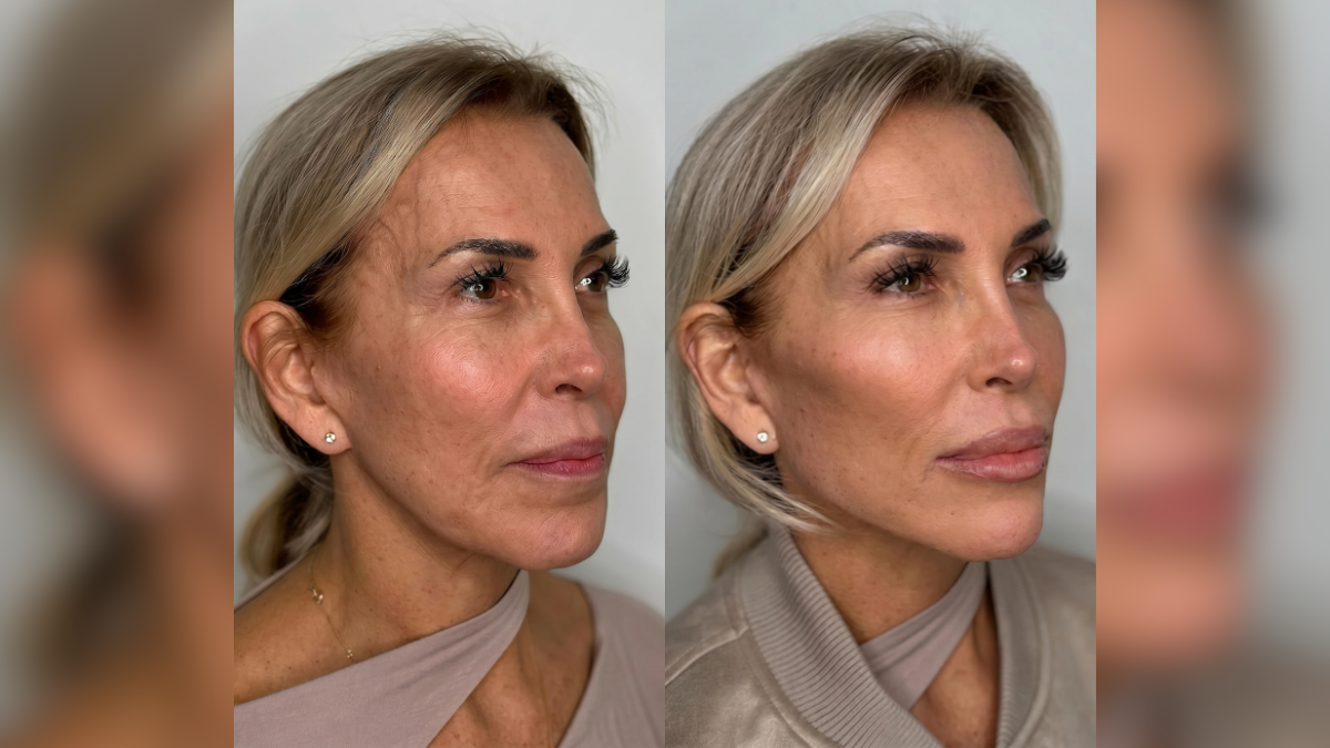 the art of invisible beauty inside the clinic redefining luxury aesthetics