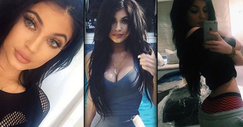 Kylie jenner plastic surgery