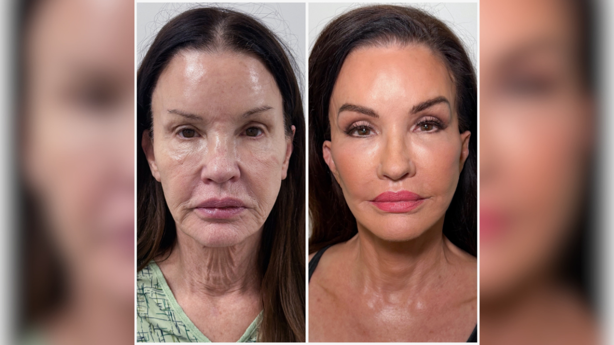 dr harrison lee and the reality of revision surgery