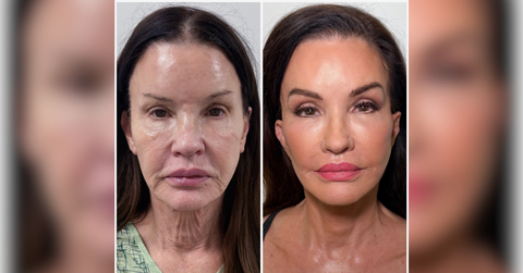 dr harrison lee and the reality of revision surgery