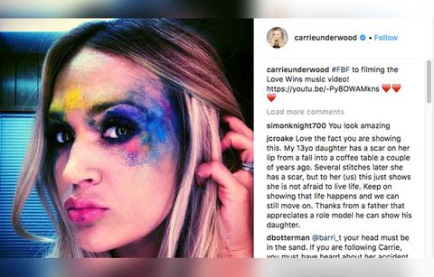 Carrie Underwood Shows Scar From Her 2017 Accident