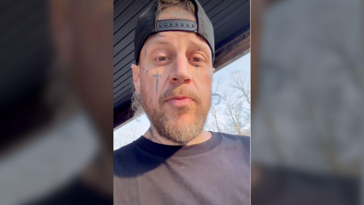 image of Jelly Roll revealed he broke his collarbone after flipping his ATV earlier this year.