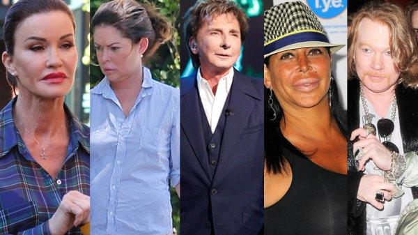 celebrity plastic surgery transformation