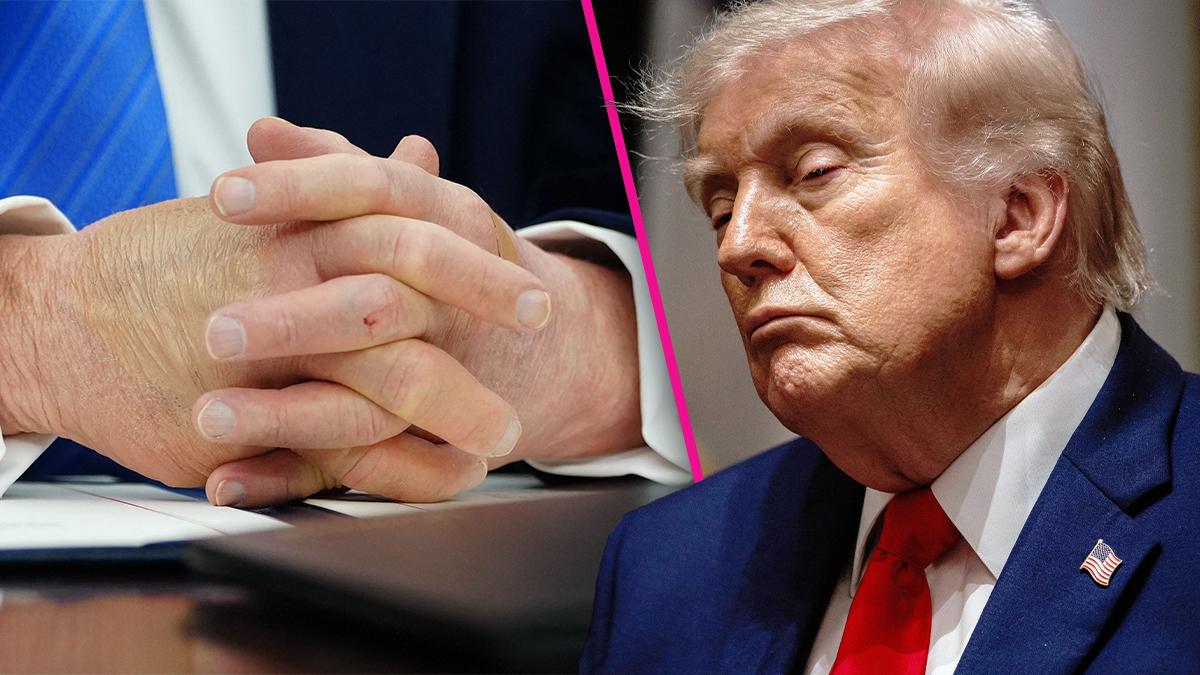Composite photo of Donald Trump and his hands.