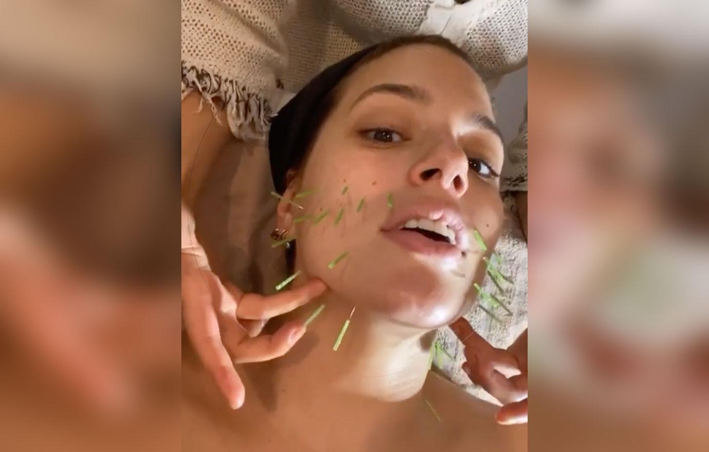 Ashley Graham Gets Facial Acupuncture in New Video