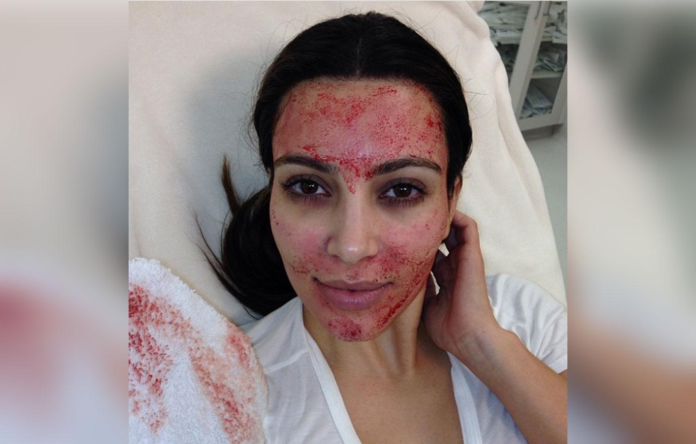 Kim Kardashian Sues Alabama Doctor Over Iconic Vampire Facial