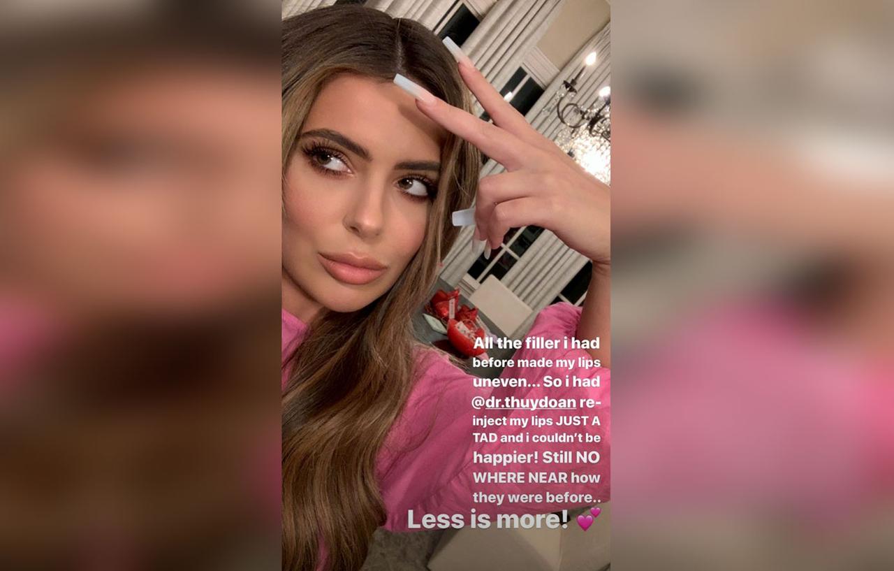 Brielle Biermann Gets More Lip Filler One Month After Dissolving It