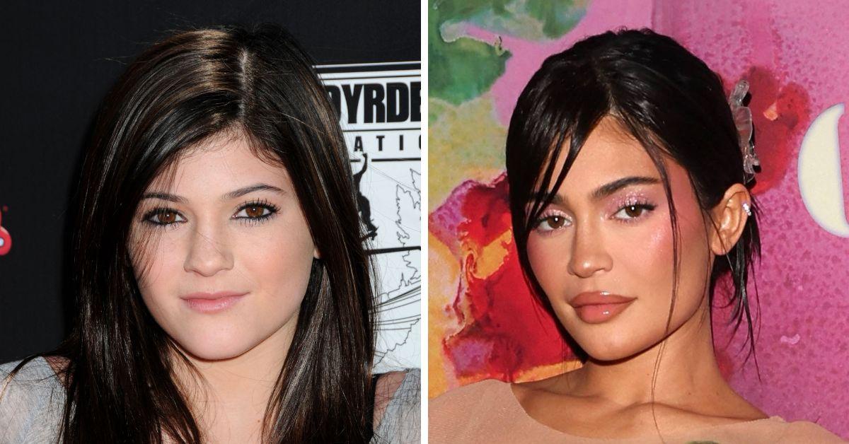 kylie jenner plastic surgery