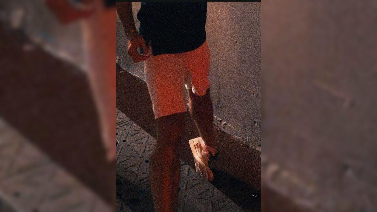 Image of Morgan Wallen showed his gruesome ankle injury via Instagram Stories.