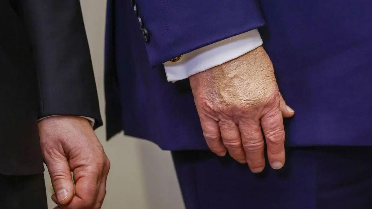 image of Donald Trump insisted he remains in perfect health despite public concern.