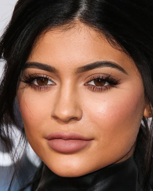 Kylie jenner face change transformation lips surgery before after 16 2015 5