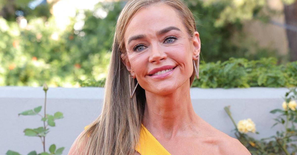 Denise Richards Details the ‘Roughest’ Part of Facelift Recovery After Undergoing Multiple Procedures