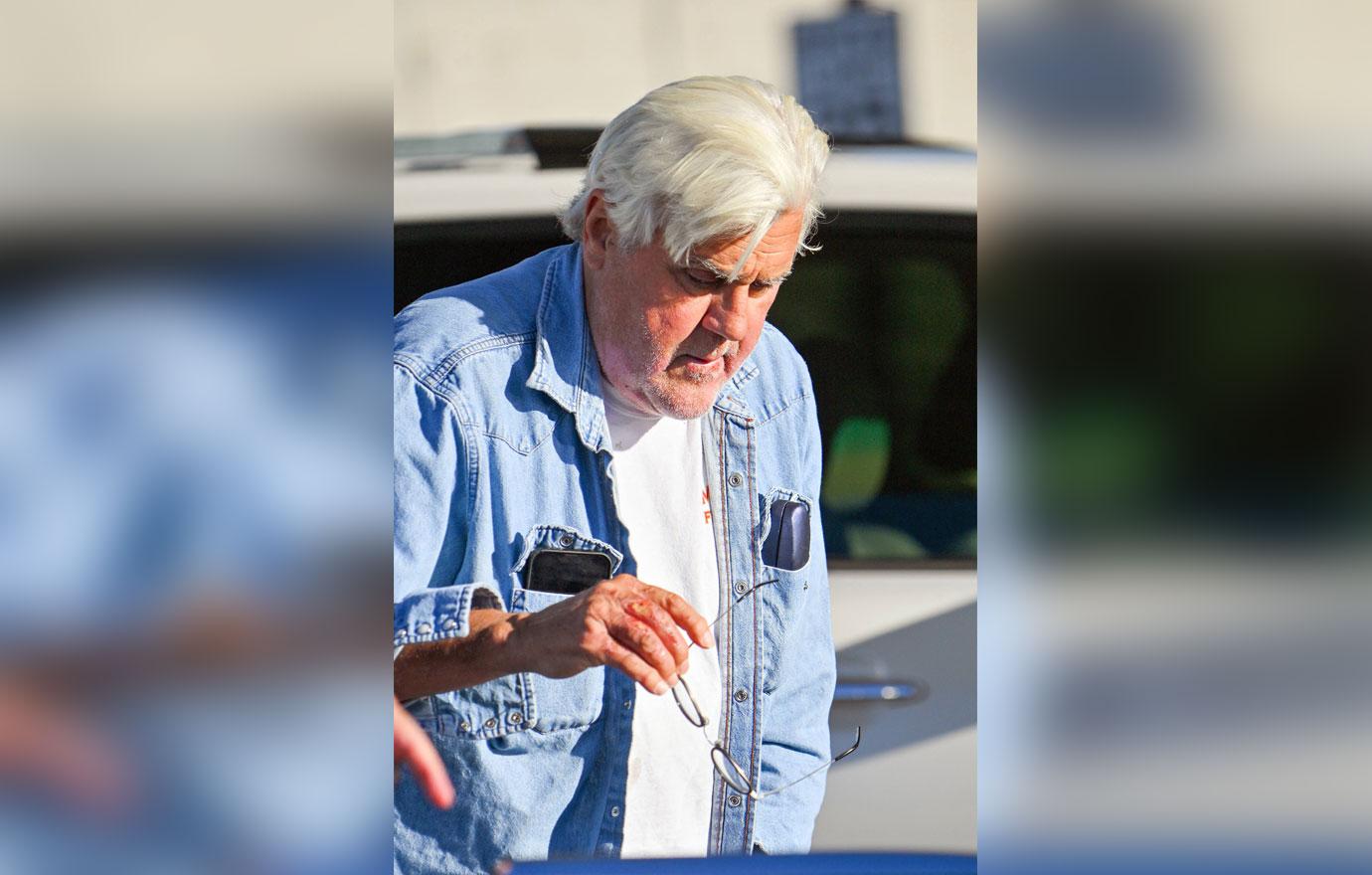 jay leno reveals caused terrifying garage explosion third degree burns