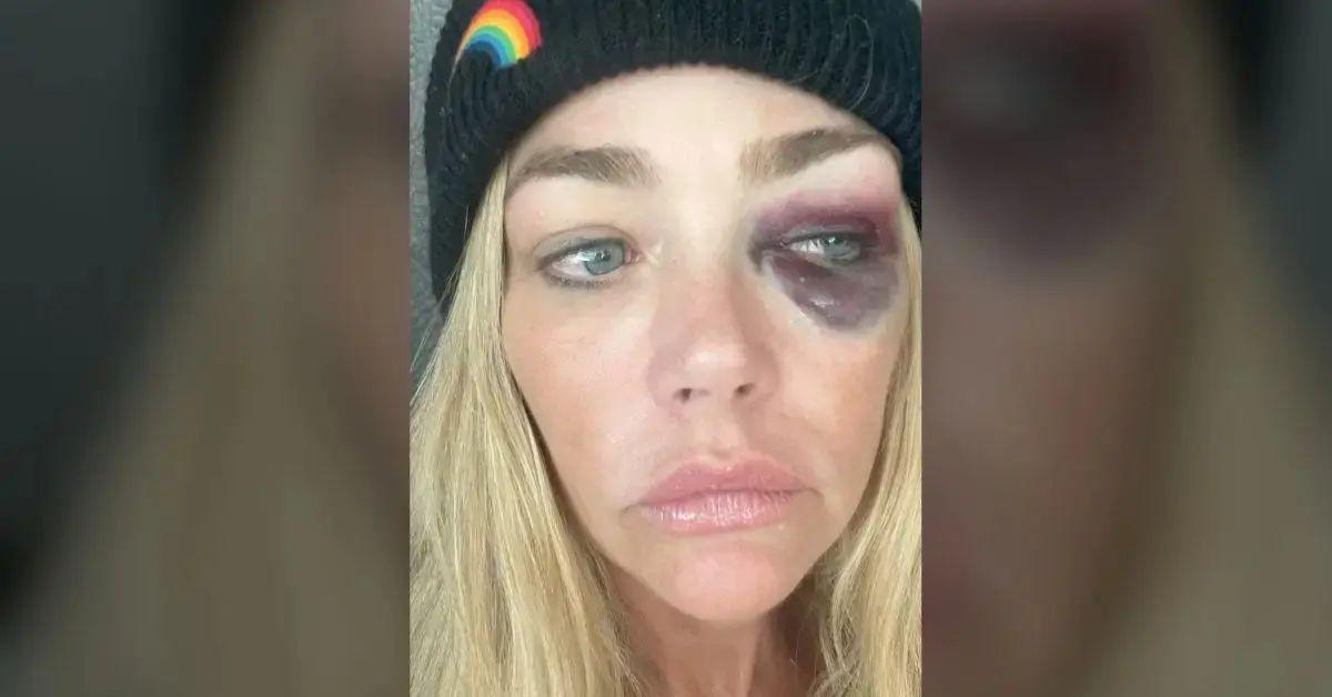 image of Denise Richards alleged her estranged husband 'almost killed' her on many occasions. 