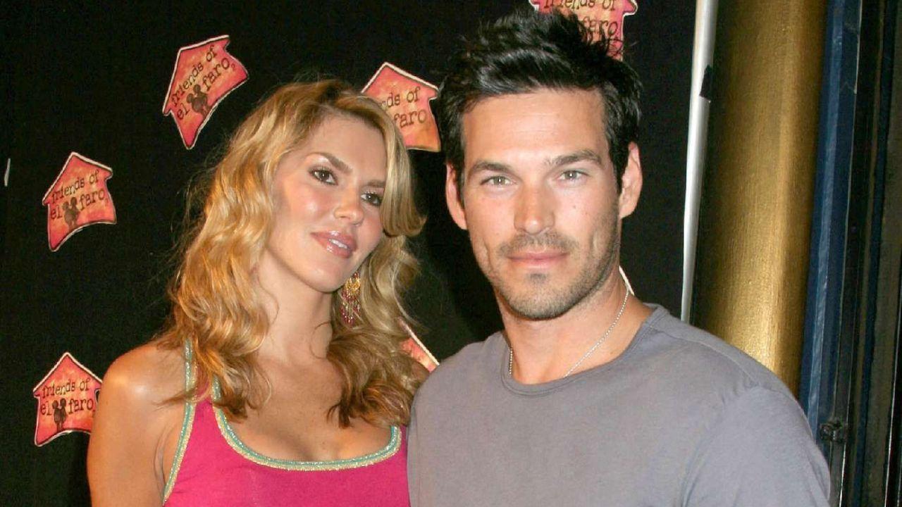 Image of Brandi Glanville opened up about her rejuvenation surgery she underwent in 2009.