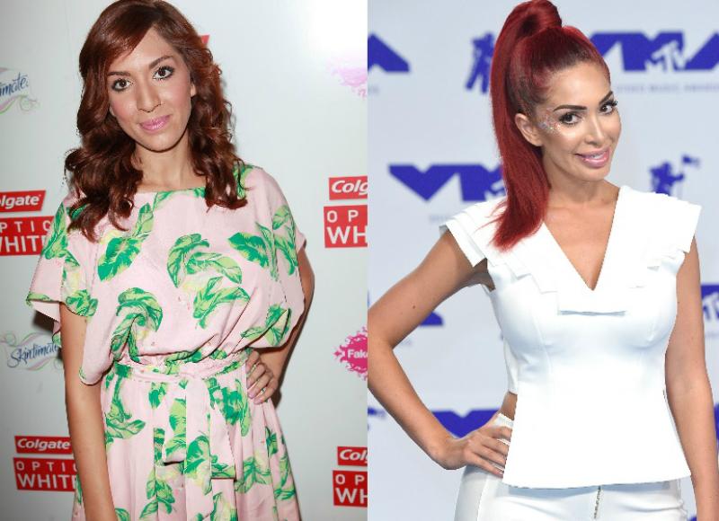 Farrah abraham celebrity plastic surgery